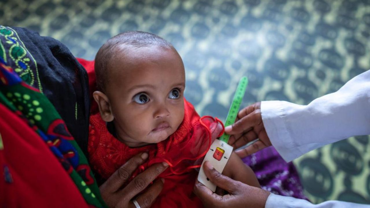 Malnutrition is costing $7.6bn to Pakistani society