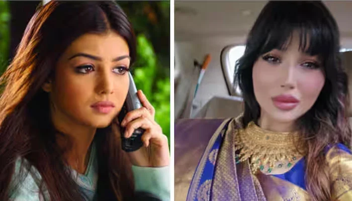 What went wrong with Ayesha Takia’s surgery? reveals Dr Gupta