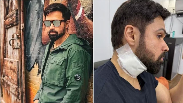 Bollywood actor Emraan Hashmi injured during shooting