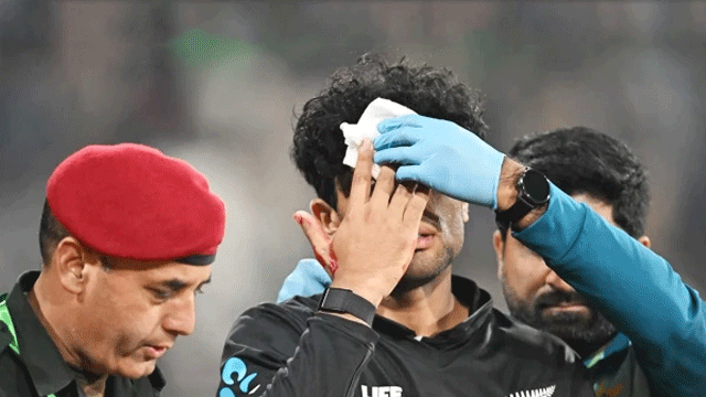 WATCH: Rachin Ravindra injures after being hit in face