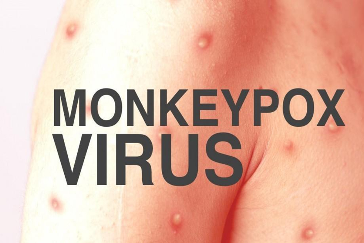 Karachi reports first mpox case