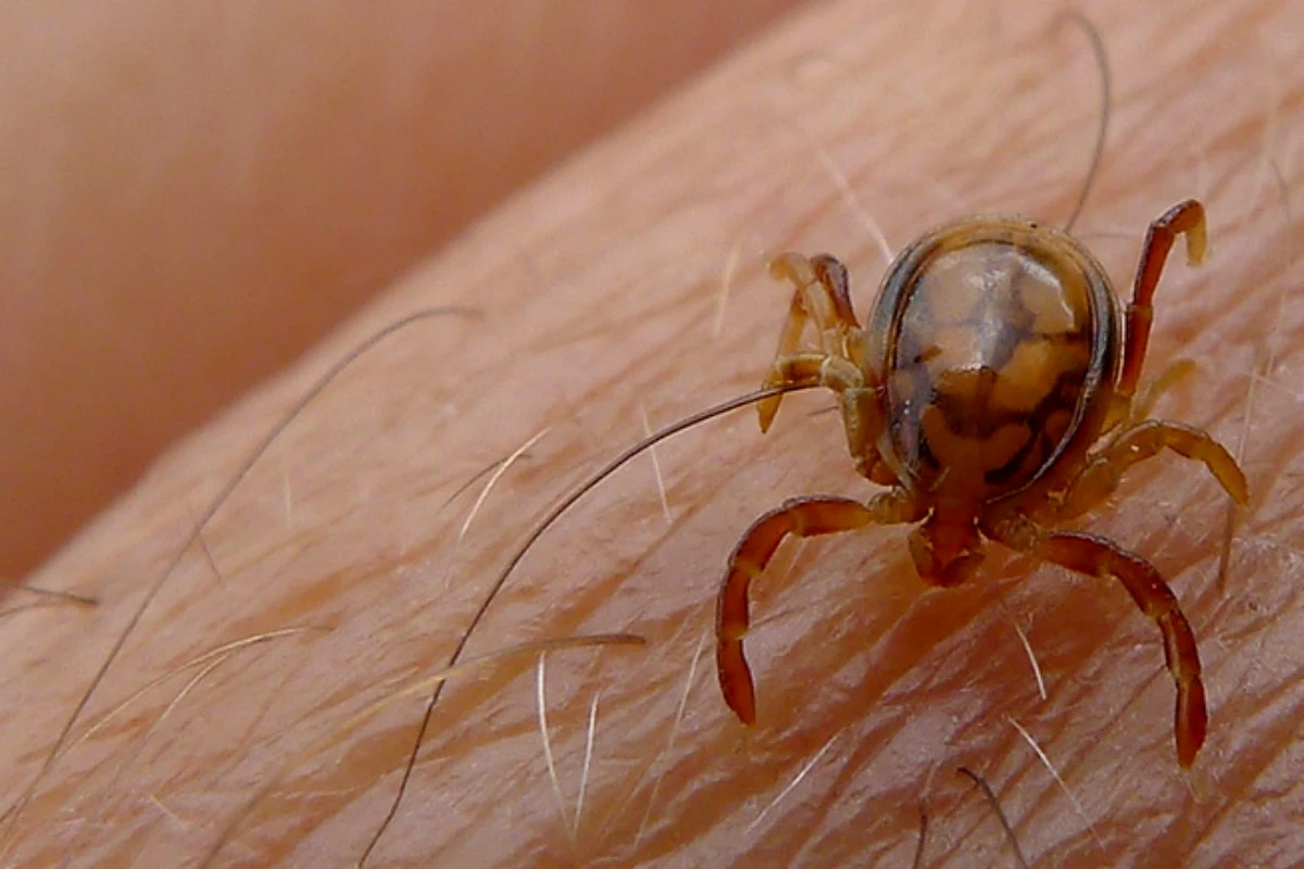 NIH issues health advisory on Congo virus ahead of Eid al-Adha