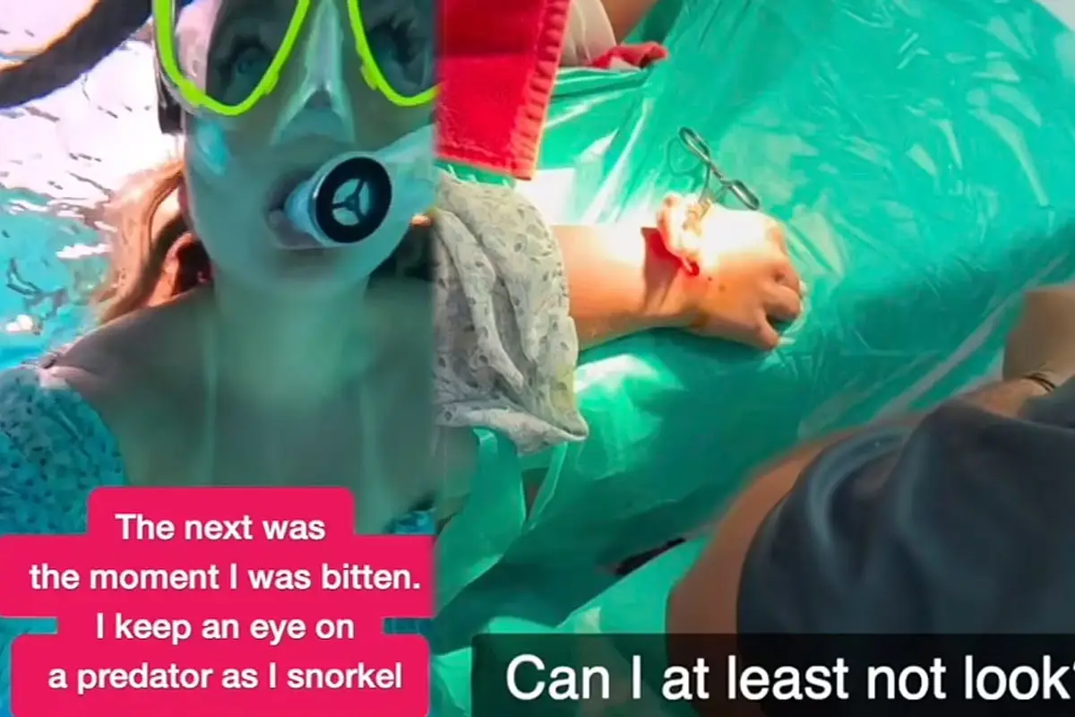 Shark Attack Caught on Camera: Ekaterina Alexandrova Miracle Survival Story