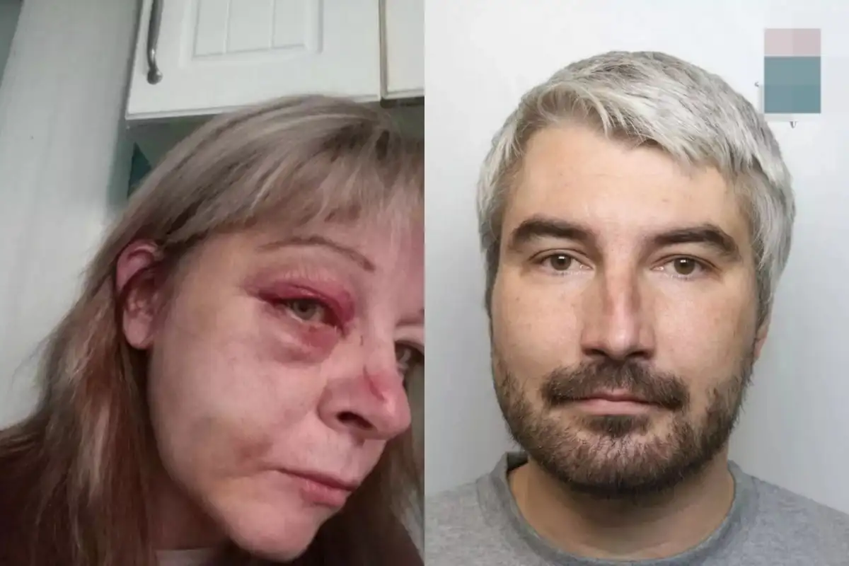 Sharon Annoscia Shares Harrowing Ordeal of Domestic Abuse After Relationship Turns Violent