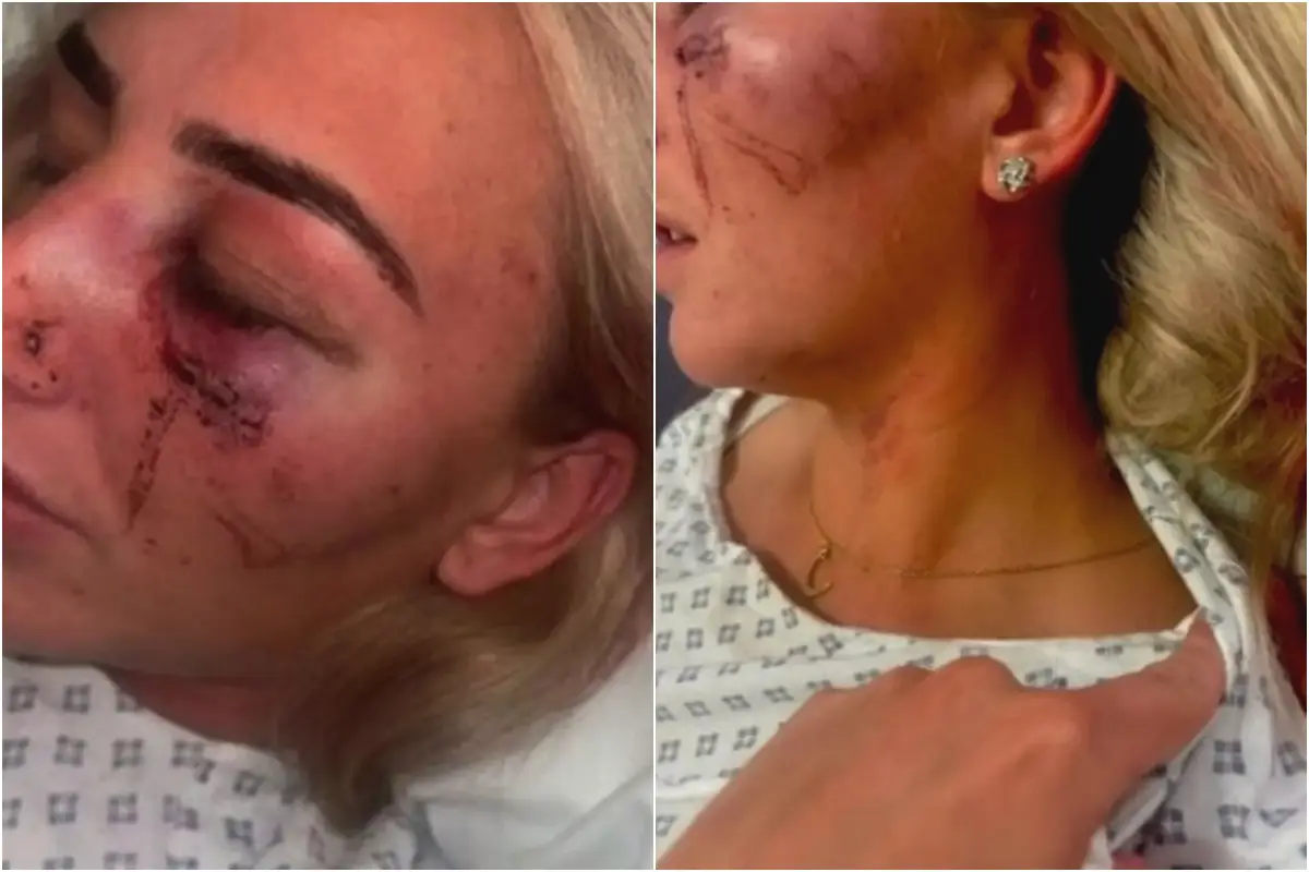 Nicole Hollinshead feared for life after date turns violent