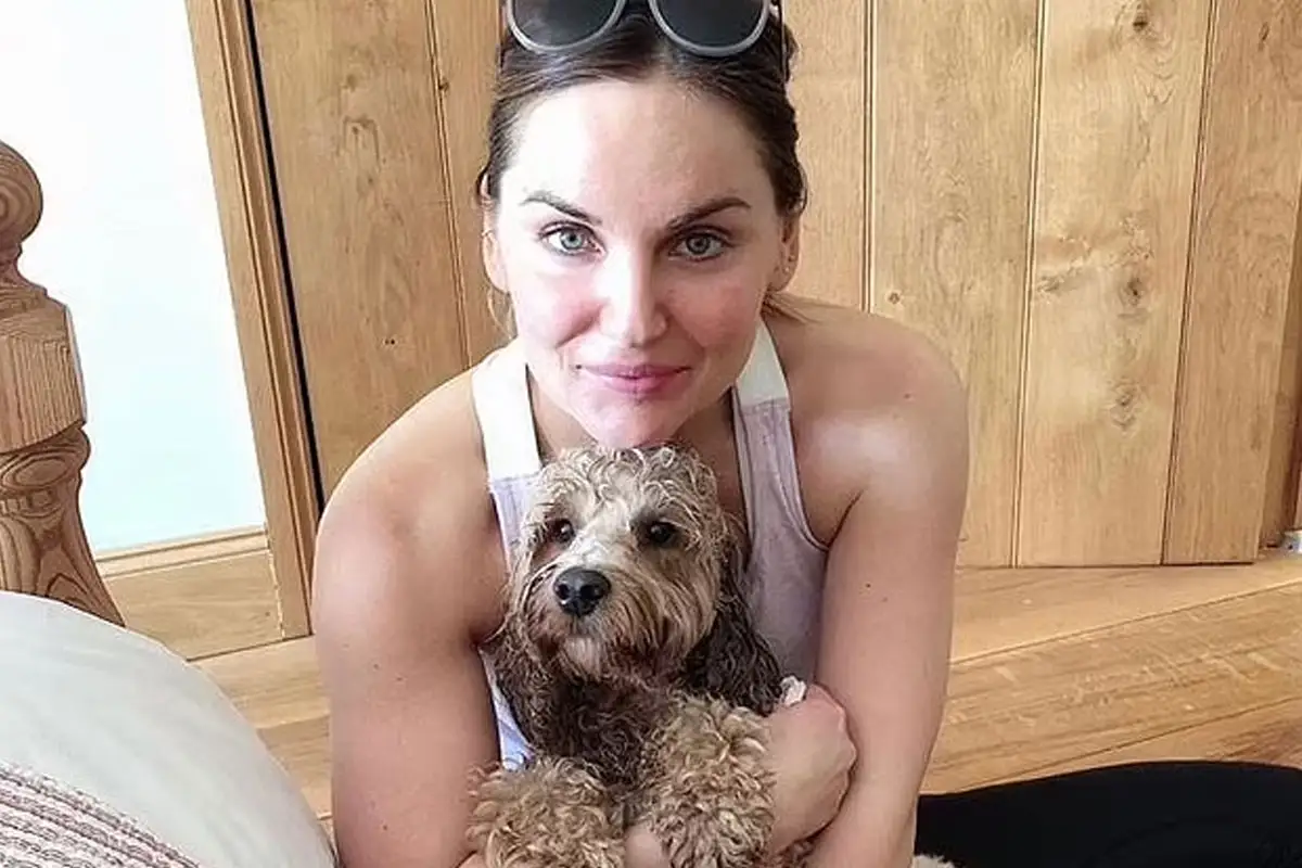 Hollywood Makeup Artist Charlie Hounslow Diagnosed with Deadly Brain Tumour After Sudden Headache