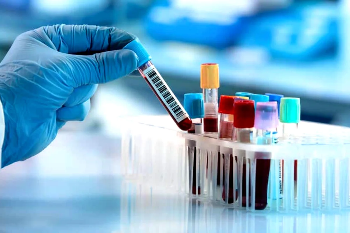 Punjab announces new rates for Dengue tests in private labs