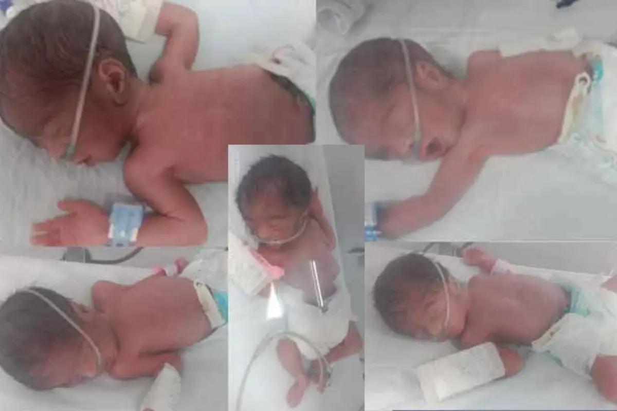 Karachi Couple Welcomes Quintuplets, Seeks Urgent Medical Support