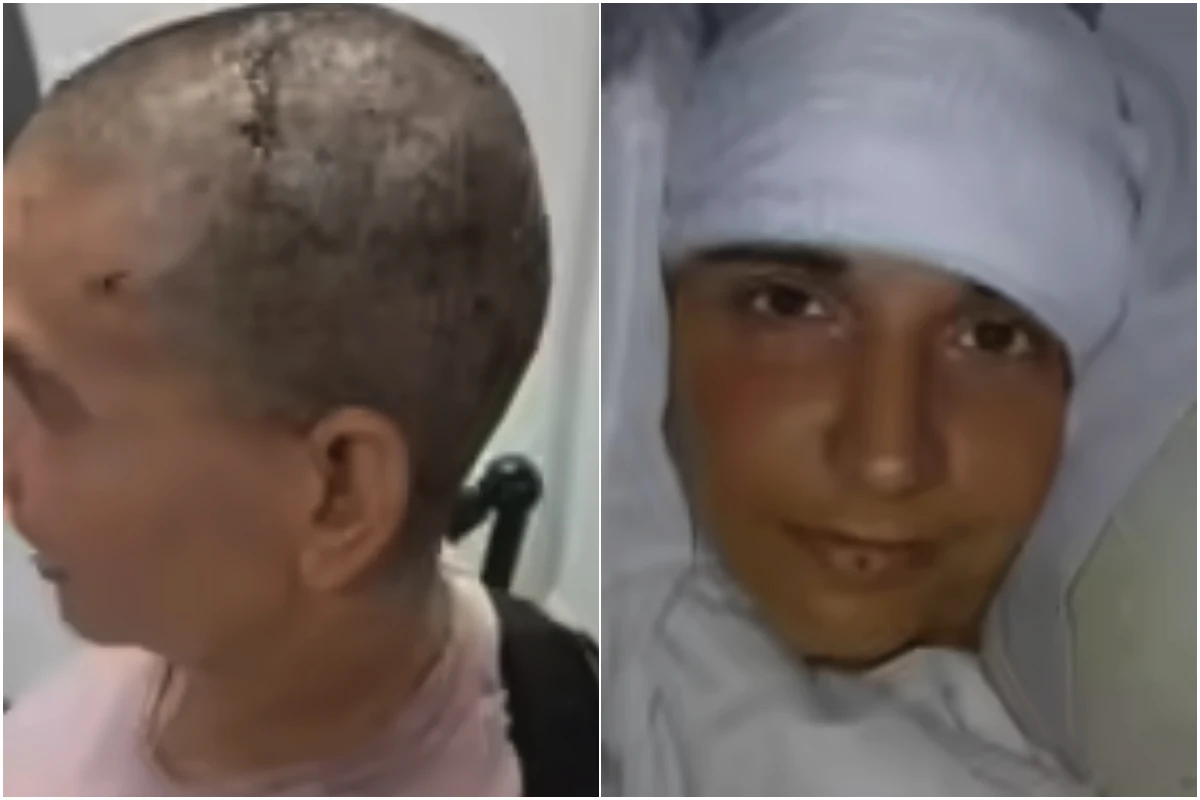 Who is Audrey Crews? Paralysed Woman Writes Her Name After 20 Years with Neuralink Brain Chip