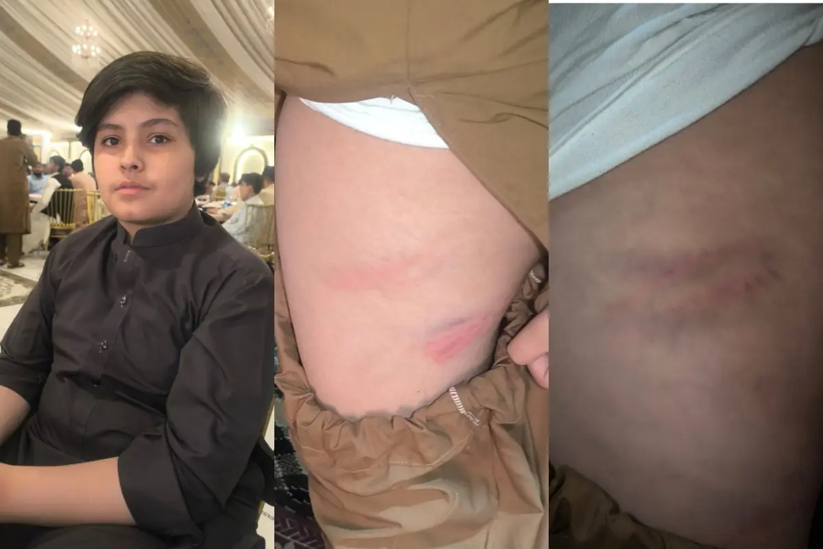 Who is Sher Adam? Sixth Grader Allegedly Tortured by School Principal in Quetta