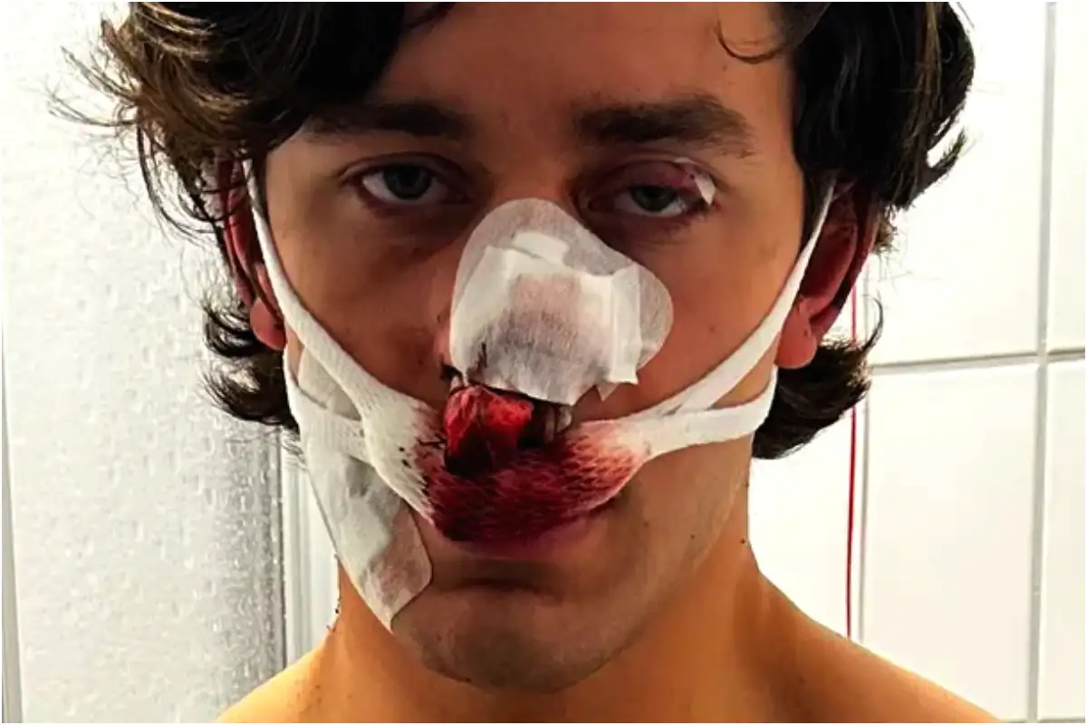 Who is John Rudat? NY Model Injured While Protecting Women in German Tram