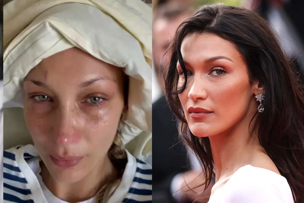 Bella Hadid Shares Hospital Photos Amid Ongoing Lyme Disease Battle