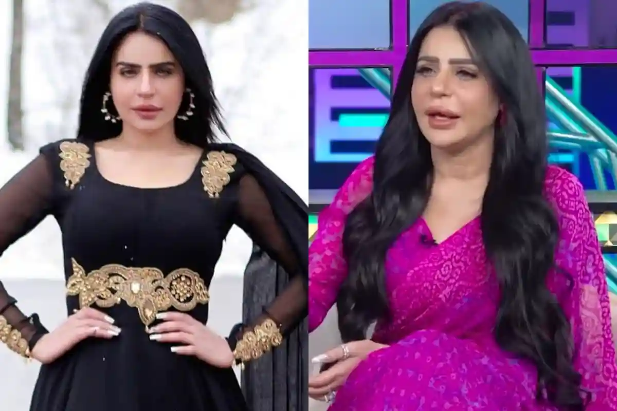 TikToker Dolly Responds to Long-Standing Plastic Surgery Rumors Linked to Her