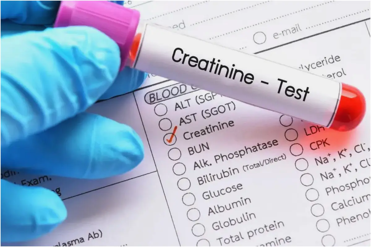 How to Safely Lower Creatinine Levels Naturally