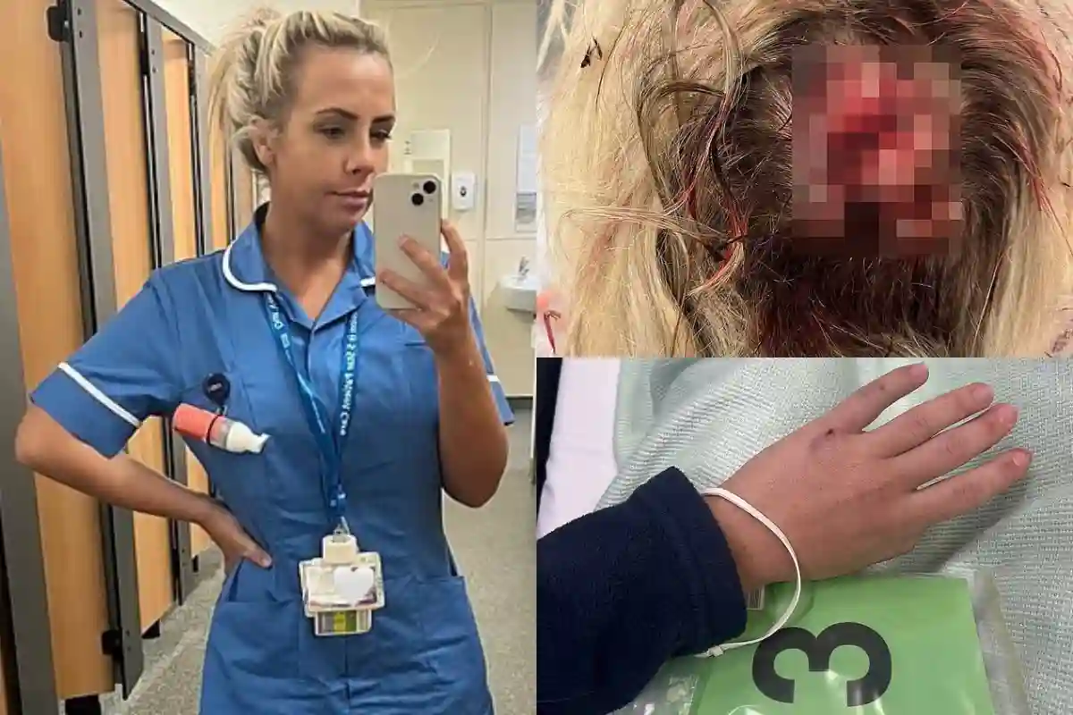 Nurse Meg Lynch Survives Brutal Crowbar Attack by Afghan Migrant in Merseyside Hospital